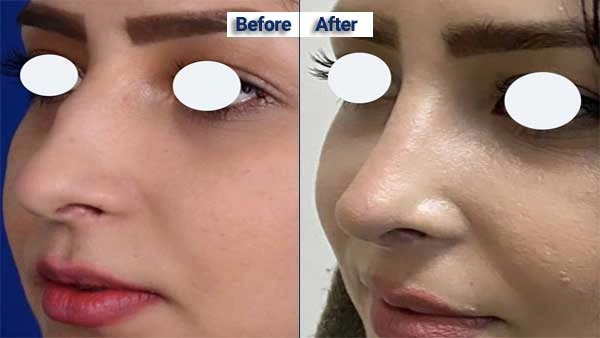 دکتر محمدرضا نظری تبریز بهترین جراح زیبایی بینی در تبریز