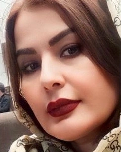 دکتر سولماز ابراهیمی تبریز از بانوان موفق در حوزه ارتودنسی و یکی از بهترین متخصص ارتودنسی تبریز